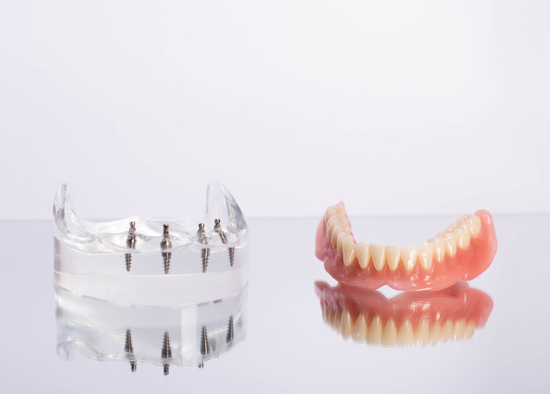 All-on-4 dental implants in San Diego cost between $14,000 and $70,000 in 2025