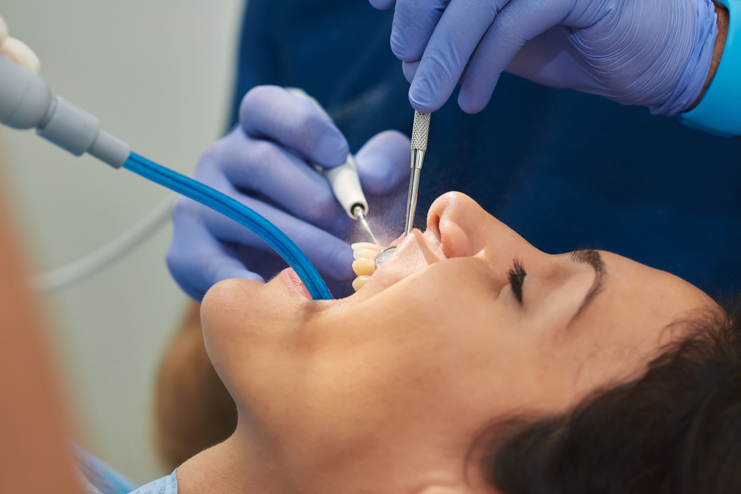 Can a Dental Cleaning Whiten Your Teeth?