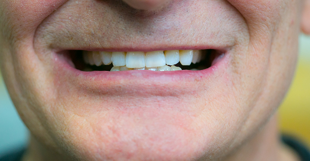 Ben ortho and crowns - After