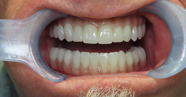 Cam Finals - all on x - After