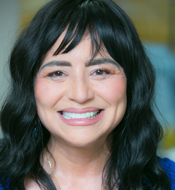 Monica veneers