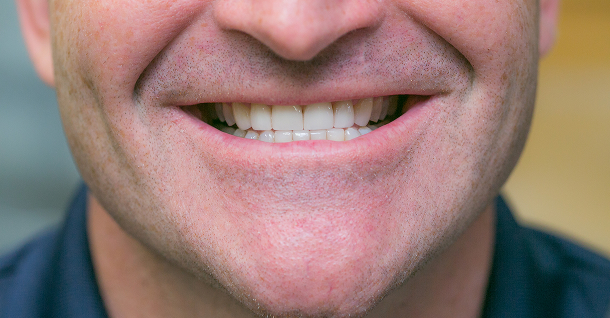 Nathan ortho and veneers - After