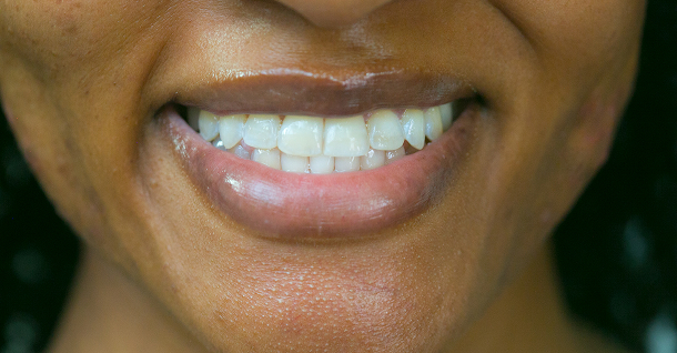 Sarah ortho - After