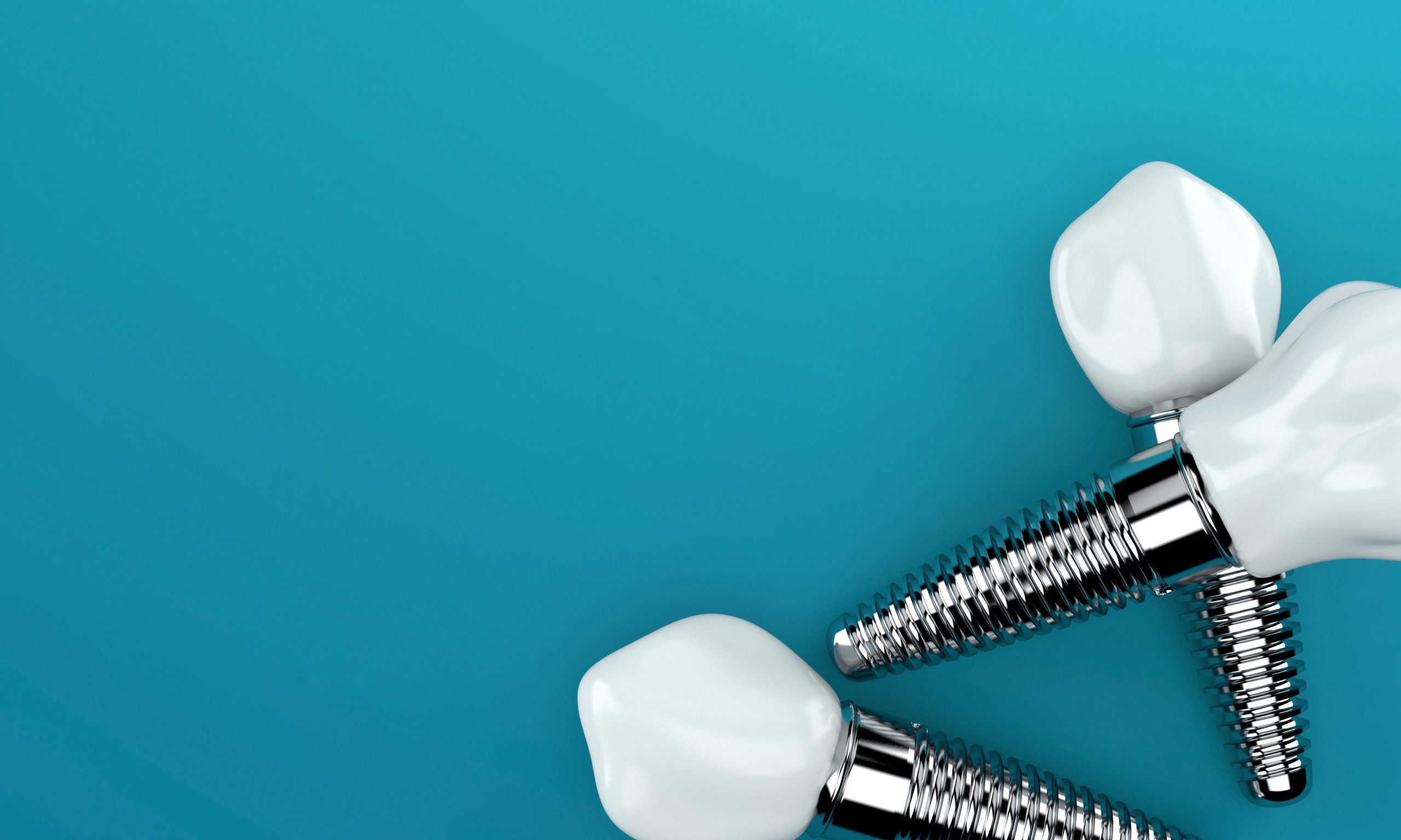 How Painful Is Getting a Dental Implant?