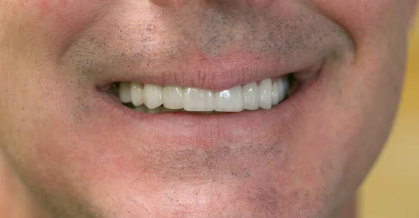 Patrick Patient After