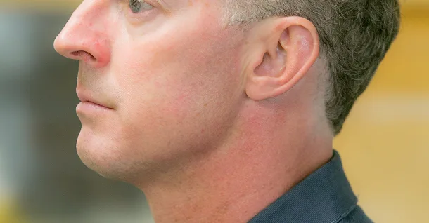 Patrick Patient After