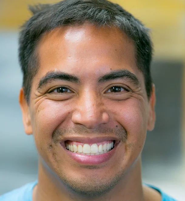 Pedro Non-Surgical Facial