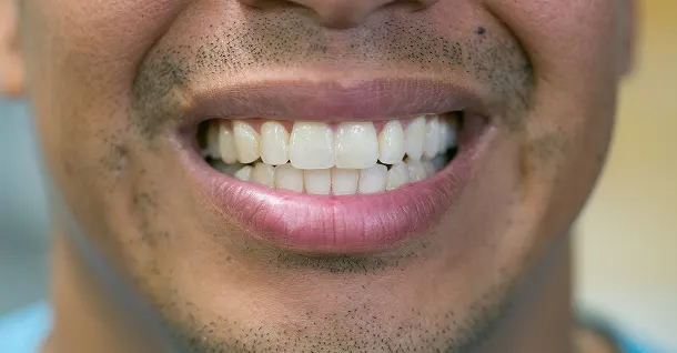 Pedro Non-Surgical Facial After