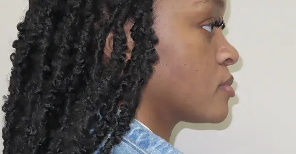 Sarah Patient Before