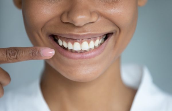 Gum color changes can be caused by genetics, smoking