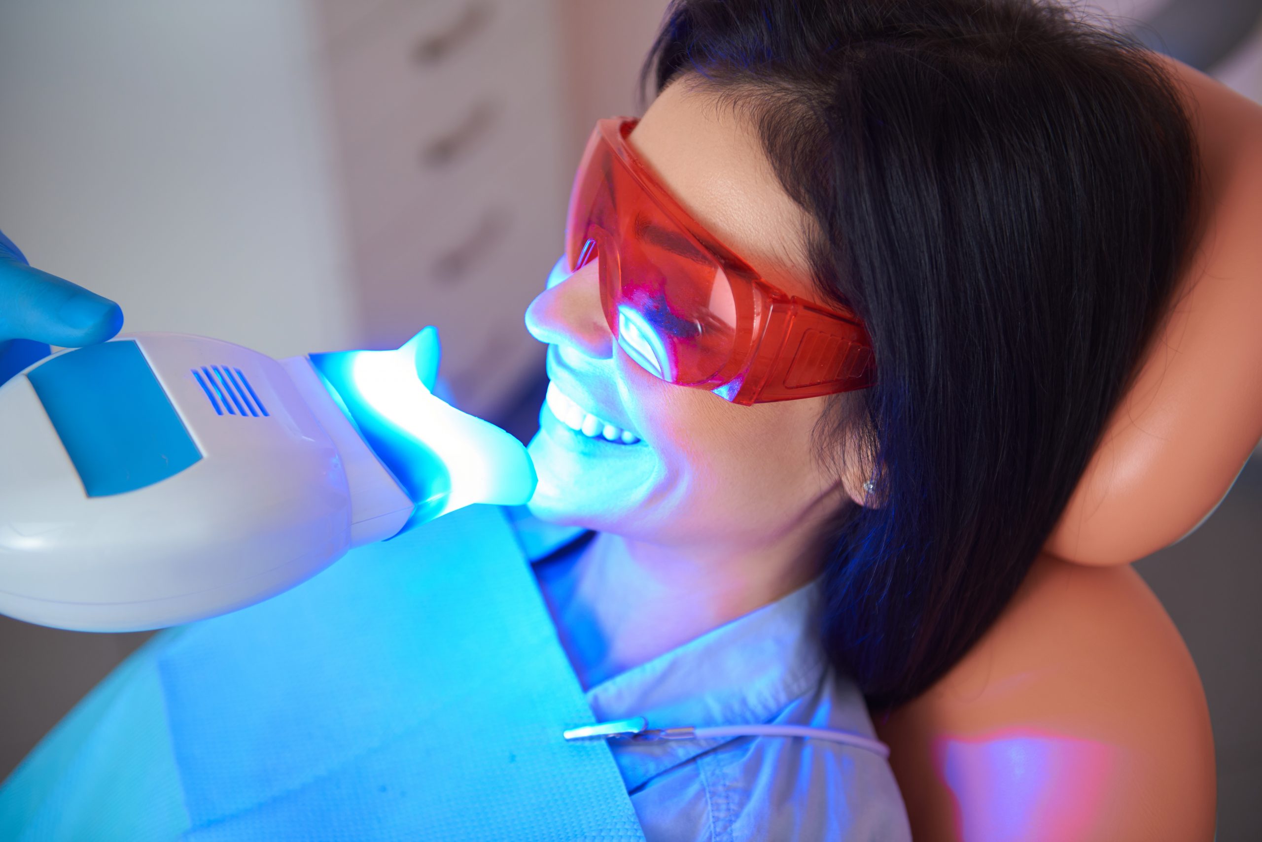 How to Find the Best Professional Teeth Whitening