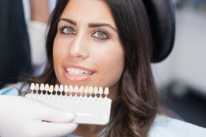 Veneers Consultation in Downtown San Diego