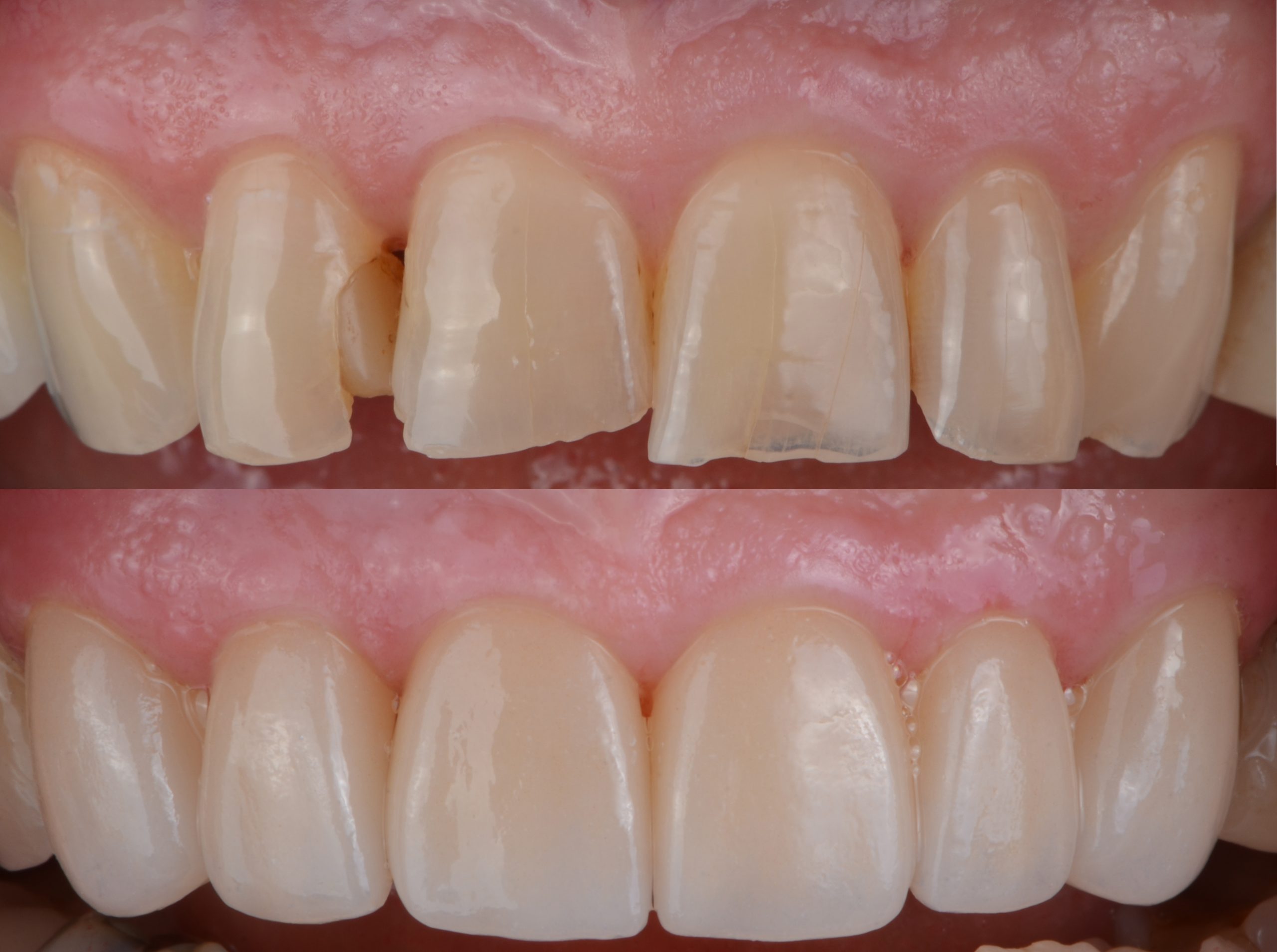 cosmetic dentistry treatment