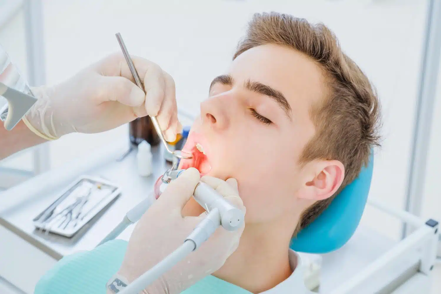 What To Know Before Getting A Root Canal Treatment